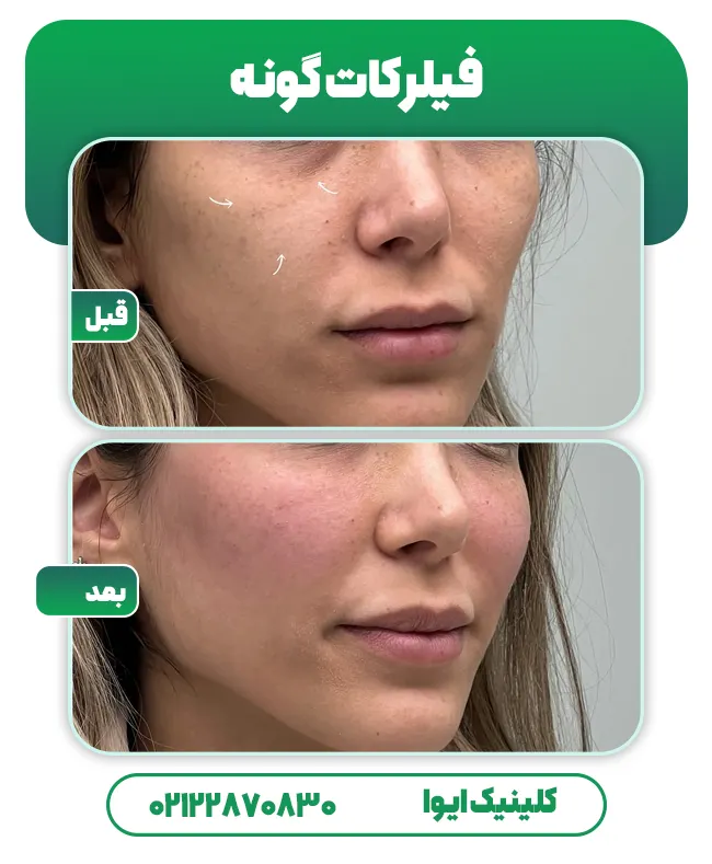 فیلر کات گونه