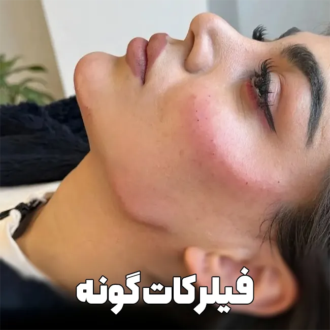 فیلر کات گونه