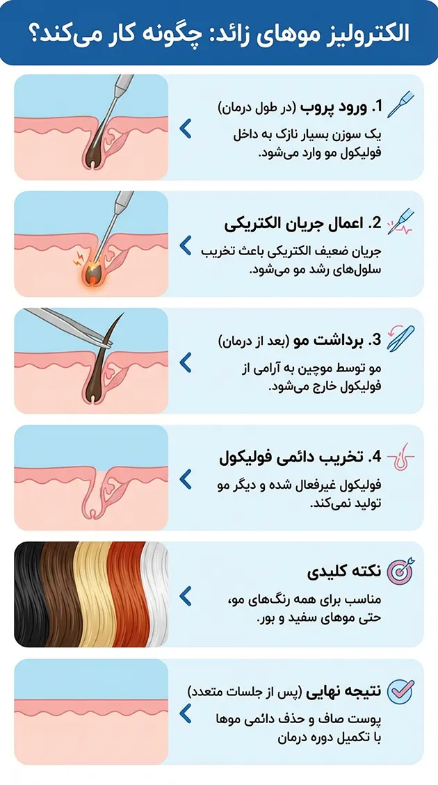 الکترولیز موی زائد