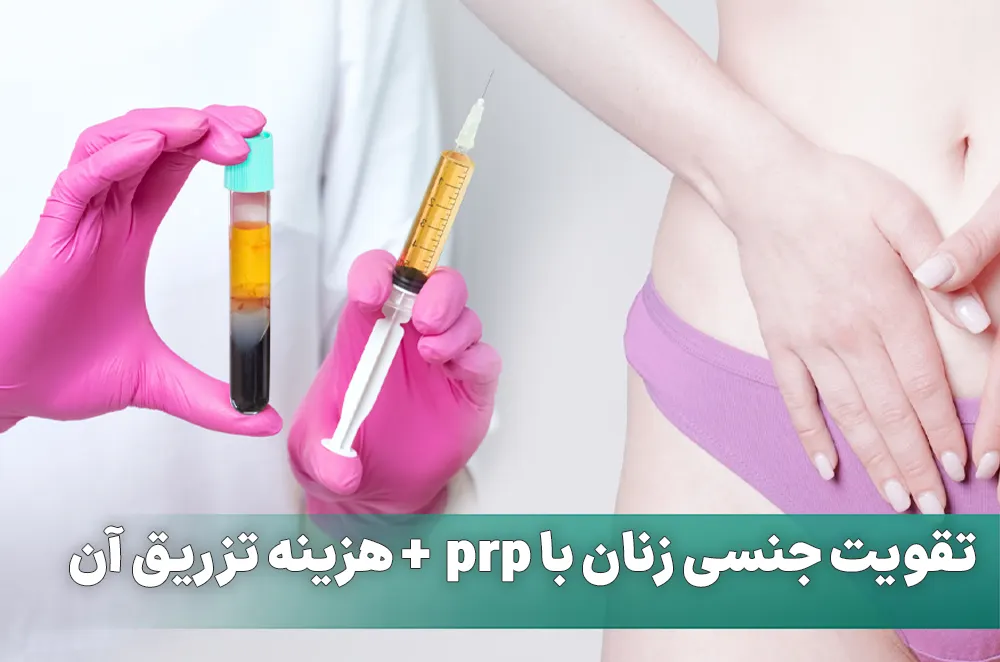 تقویت جنسی زنان با prp