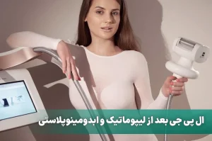 ال پی جی بعد از ليپوماتیک و ابدومینوپلاستی