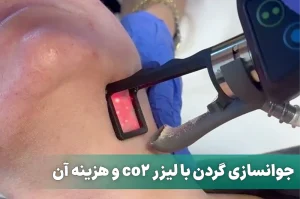 جوانسازی گردن با لیزر
