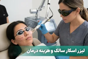 لیزر سالک