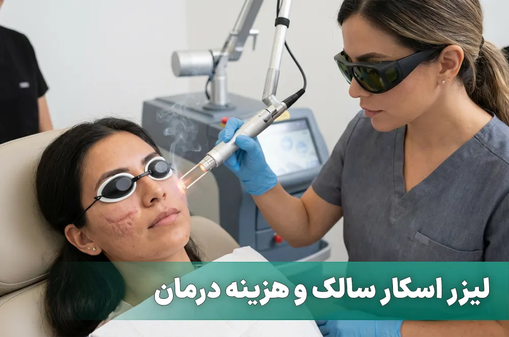 لیزر سالک