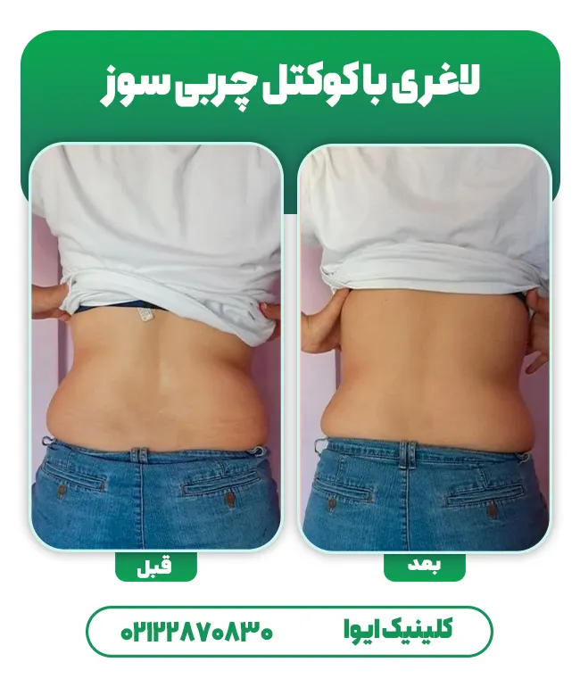 لاغری با کوکتل فیوژن