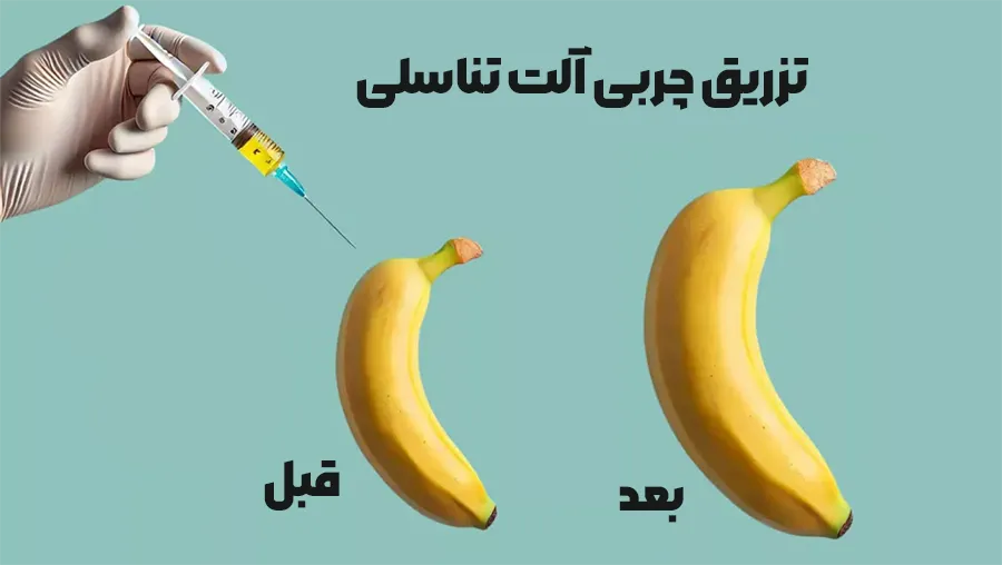 تزریق چربی آلت تناسلی