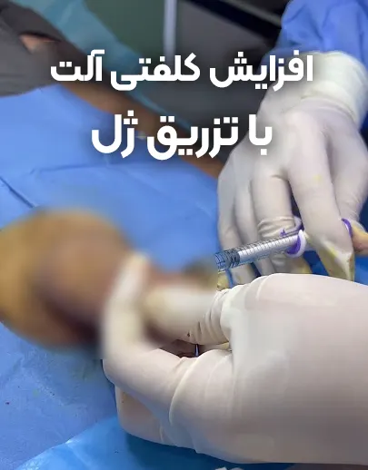 فیلر آلت تناسلی