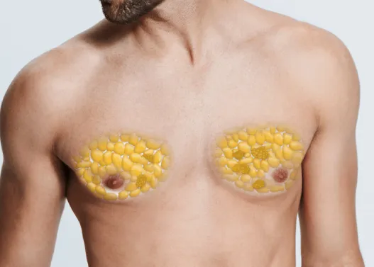 چربی سینه مردان