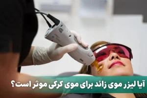لیزر موی های کرکی