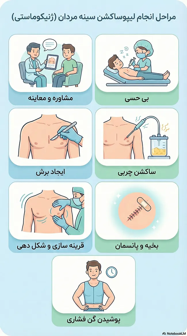 نحوه انجام لیپوساکشن سینه مردان