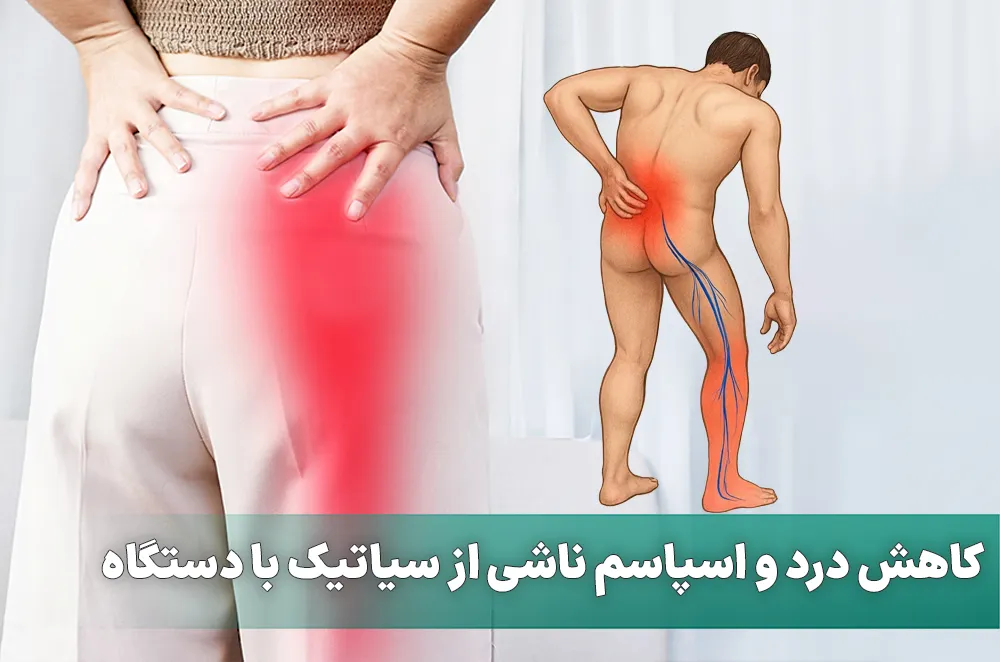 کاهش درد و اسپاسم ناشی از سیاتیک با دستگاه