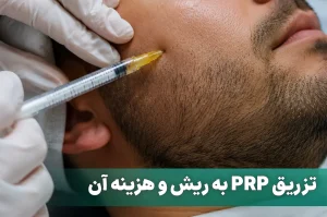 تقویت ریش و سبیل با PRP