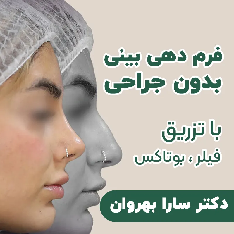 فرم دهی بینی دکتر بهروان