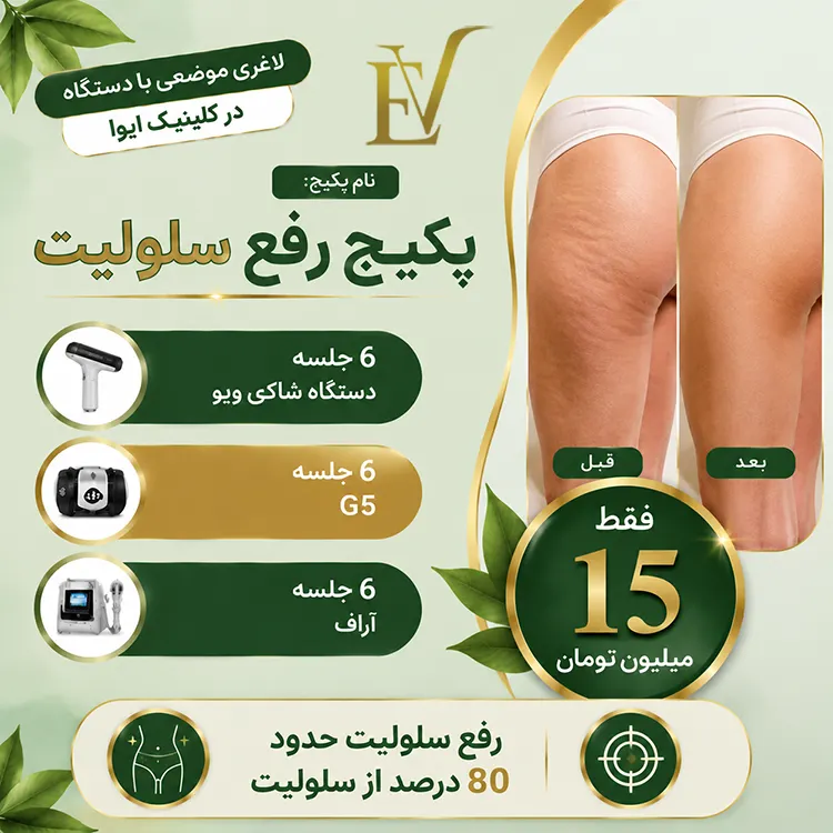 پکیج سلولیت