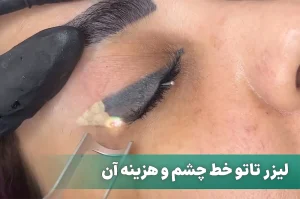 لیزر تاتو خط چشم