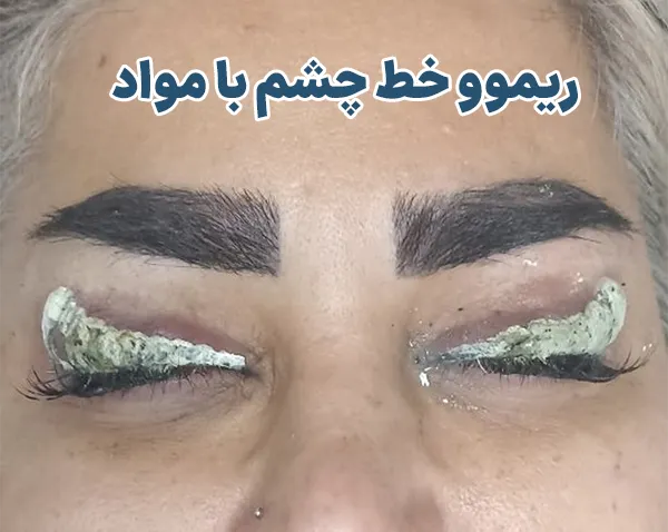 ریموور خط چشم با مواد