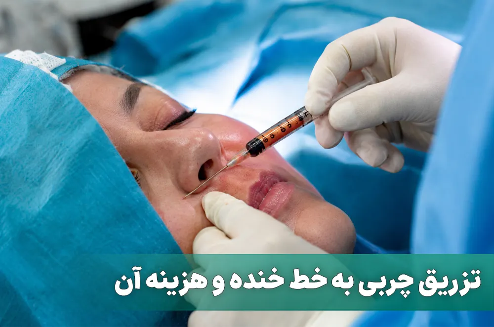 تزریق چربی به خط خنده