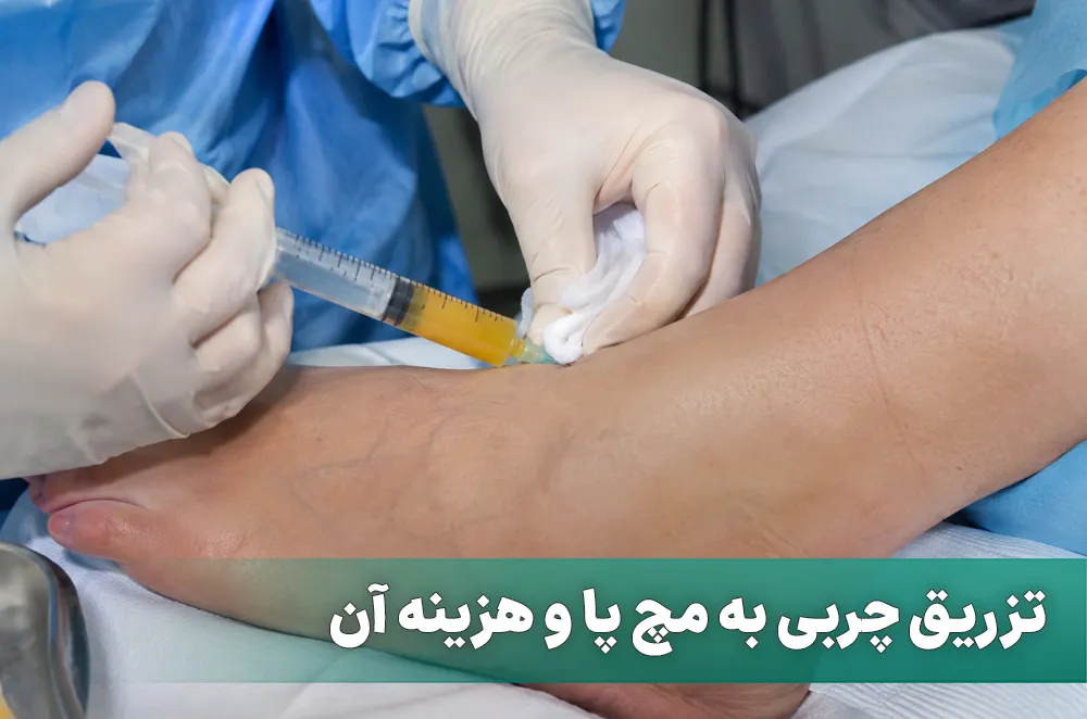 تزریق چربی به مچ پا